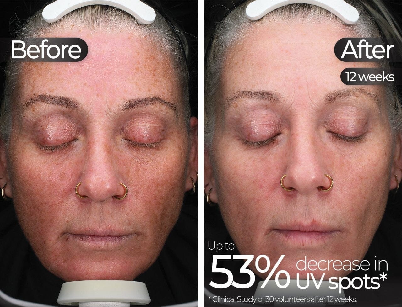 STYLPRO Wavelength Pro 5-in-1 LED Mask