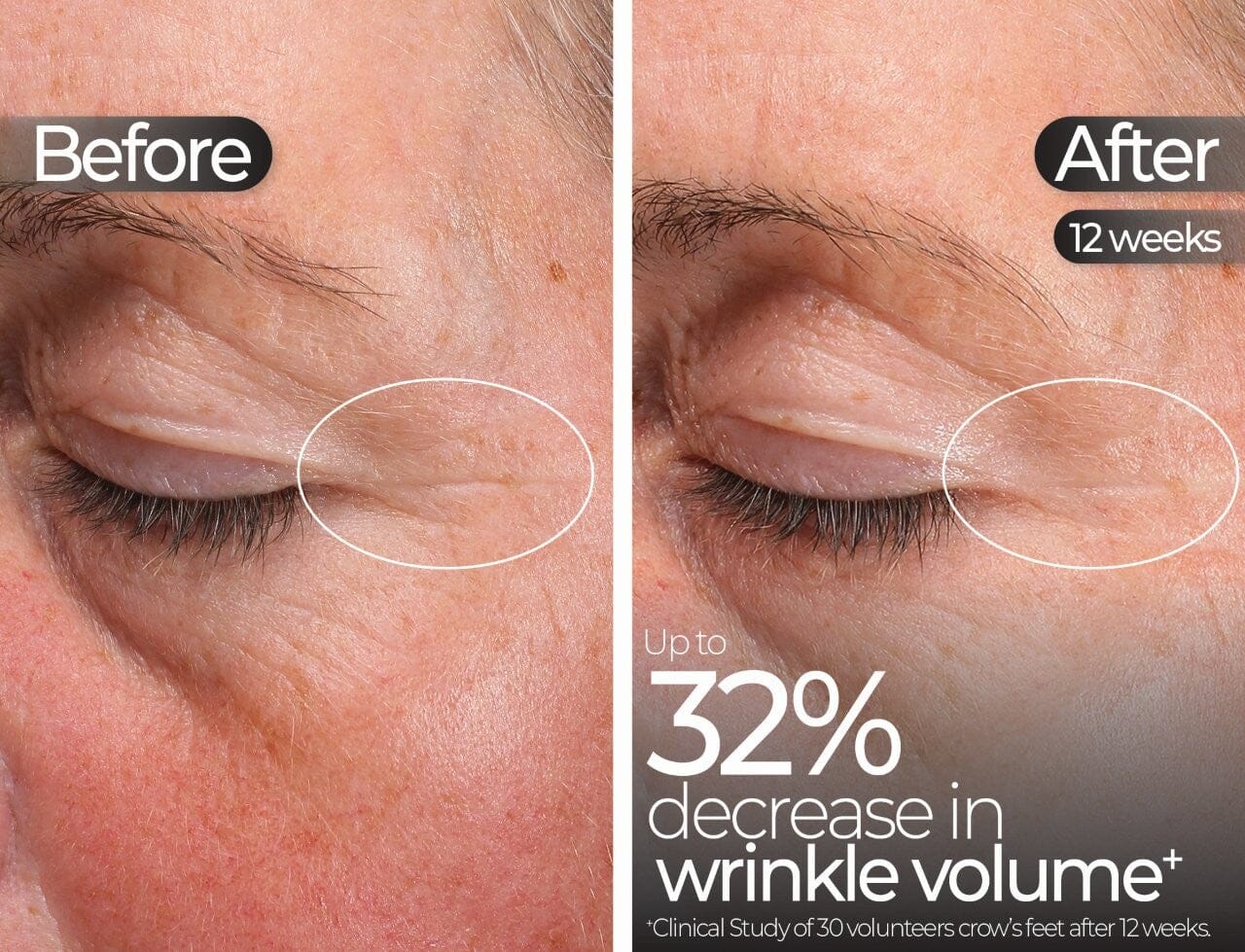 STYLPRO Wavelength Pro 5-in-1 LED Mask